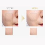 Dr. Althea Vitamin C Boosting Serum  – Ορός Λάμψης & Αναζωογόνησης (30ml) - Image 3