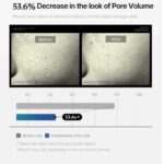 Medicube Zero Pore One-day Cream – Κρέμα Σύσφιξης Πόρων για Λιπαρό Δέρμα (50ml) - Image 2