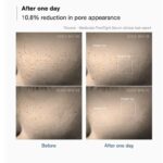 Medicube Zero Pore One Day Serum – Σέρουμ Σύσφιξης Πόρων & Ρύθμισης Λιπαρότητας (30ml) - Image 3
